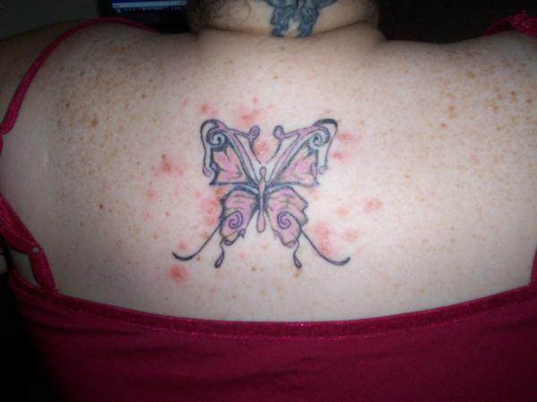 Kaip nustatyti ir ištaisyti užkrėstą tatuiruotę