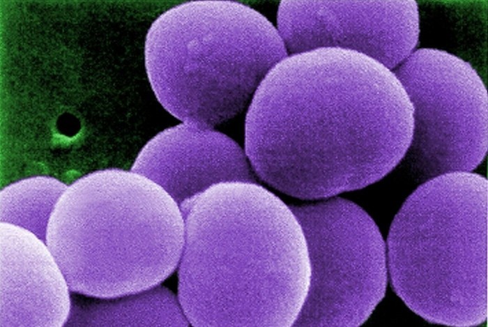 STAPHYLOCOCCUS antibakteriální vlastnosti bambusu