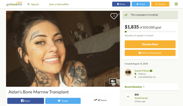 Erkek arkadaşı Dan Fithian, yazının Aidan'ın kemik iliği naklini finansal olarak destekleyebileceğini umarak Aidan'ın GoFundMe sayfasını kurmuştu. Gönderisi, Aidan'ın sağlık sorunlarının ana hatlarını çiziyor ve “sonuç olarak, son 6 yıldır aşağıdaki geri dönüşü olmayan / yanlış teşhis edilen sağlık sorunlarıyla yüzleşmek zorunda kaldığını… bunların tümü, 2012'de henüz yaşının altındayken geçirdiği bir ameliyattan kaynaklanıyor. 18.